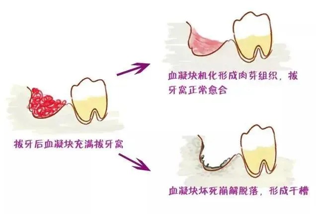 柳州牙齿矫正