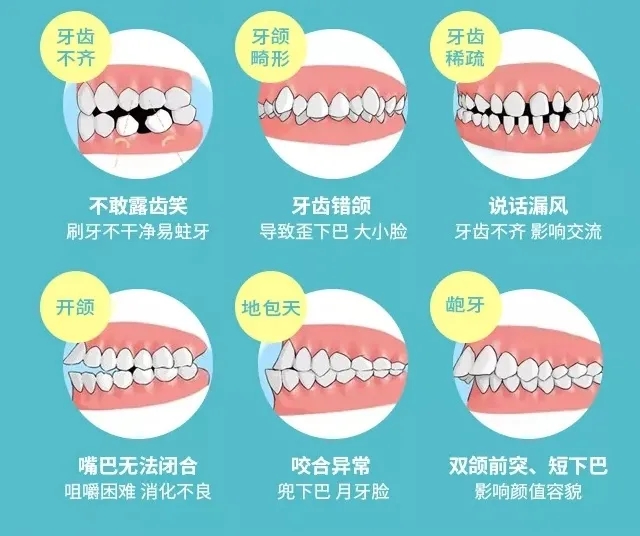 柳州牙齿矫正